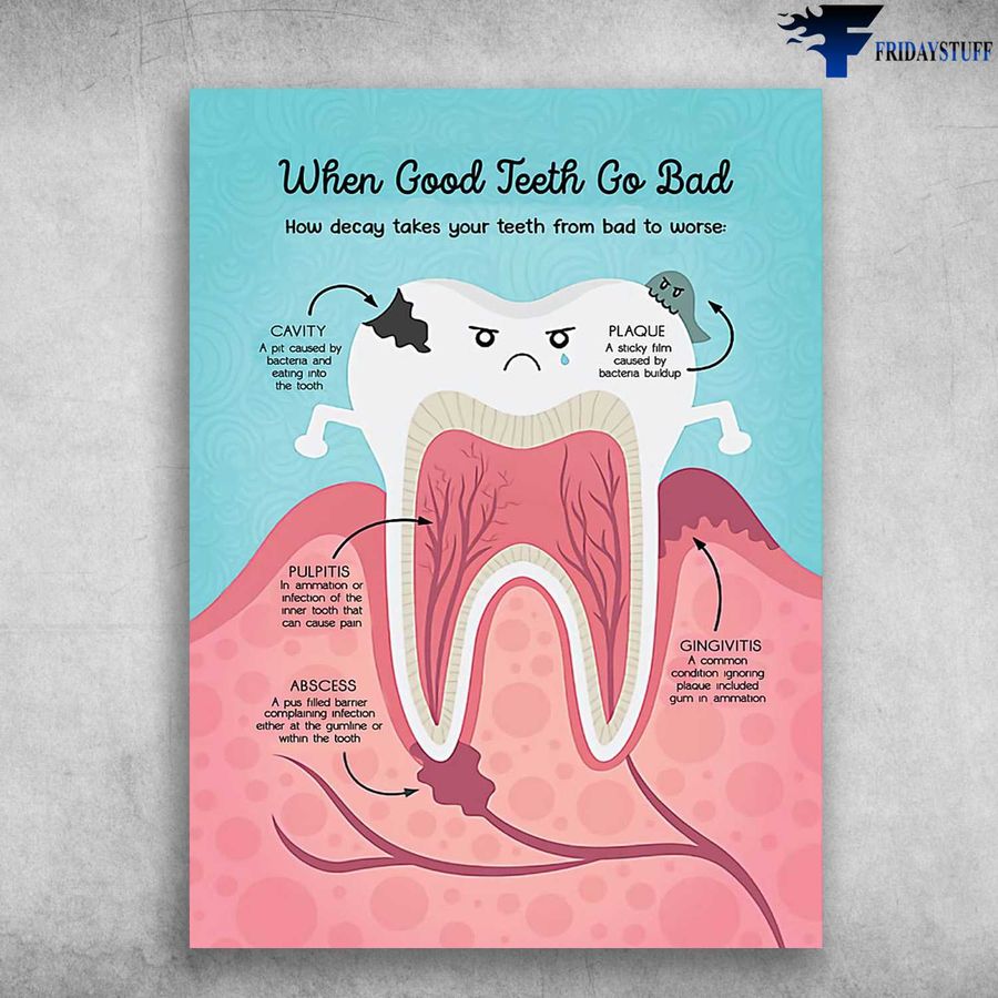 Teeth Care, Dentist Poster – When Good Teeth Go Bad, How Decay Takes From Bad To Worse, Cavity Home Decor Poster Canvas